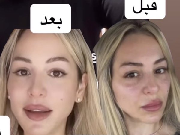לקוחה בלוגרית 